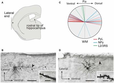 Comparison of the Upper Marginal Neurons of Cortical Layer 2 with Layer 2/3 Pyramidal Neurons in Mouse Temporal Cortex